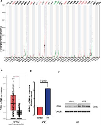 ITGAL as a prognostic biomarker correlated with immune infiltrates in melanoma